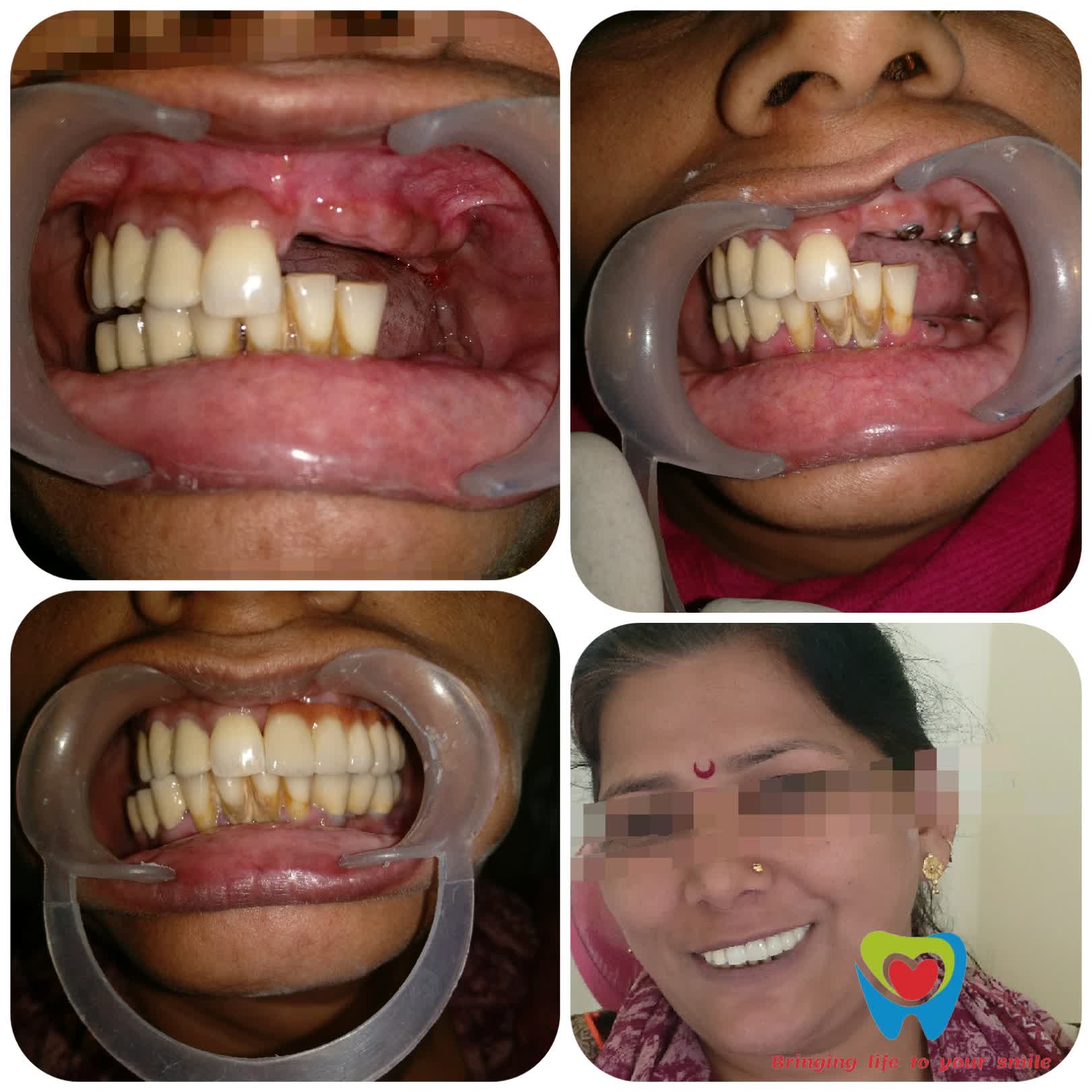 Best Dental Clinic In Nagpur